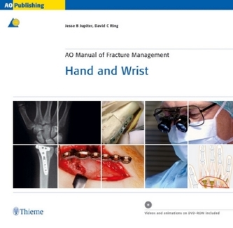 AO Manual of Fracture Management Hand and Wrist, with CD-ROM AO Manual of Fracture Management Hand and Wrist, with CD-ROM