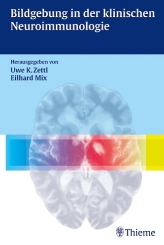 Bildgebung in der klinischen Neuroimmunologie Bildgebung in der klinischen Neuroimmunologie