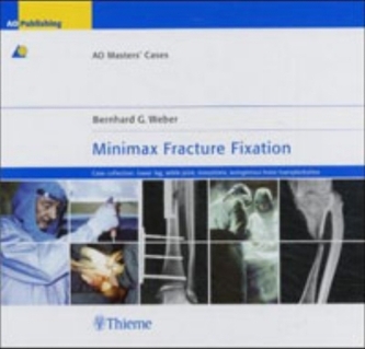 Minimax Fracture Fixation Minimax Fracture Fixation