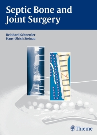 Septic Bone and Joint Surgery Septic Bone and Joint Surgery