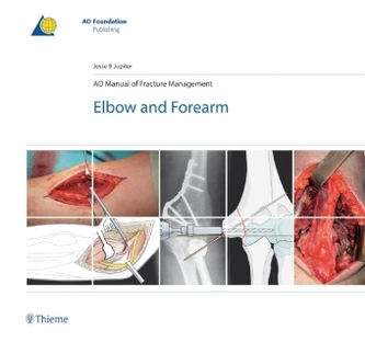 AO Manual of Fracture Management AO Manual of Fracture Management
