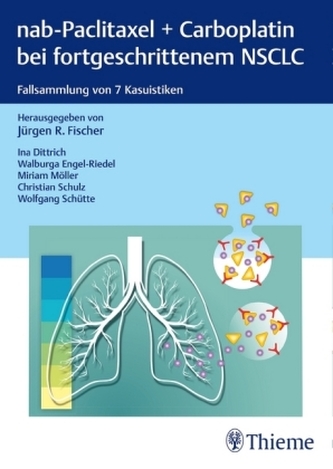 nab-Paclitaxel + Carboplatin bei fortgeschrittenem NSCLC