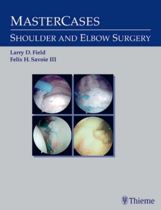 Master Cases, Shoulder and Elbow Surgery