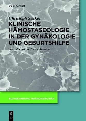 Klinische Hämostaseologie in der Gynäkologie und Geburtshilfe Klinische Hämostaseologie in der Gynäkologie und Geburtshilfe