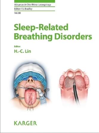 Sleep-Related Breathing Disorders Sleep-Related Breathing Disorders
