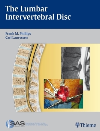 The Lumbar Intervertebral Disc The Lumbar Intervertebral Disc