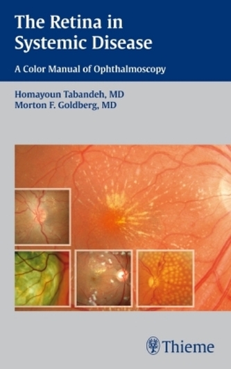 The Retina in Systemic Disease