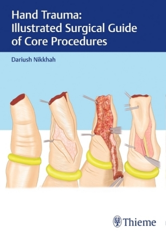 Hand Trauma: Illustrated Surgical Guide of Core Procedures Hand Trauma: Illustrated Surgical Guide of Core Procedures