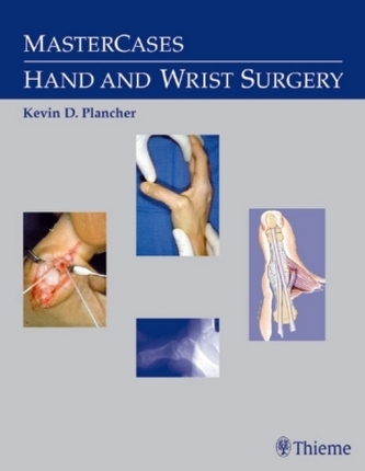 Hand and Wrist Surgery