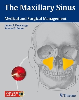 The Maxillary Sinus, w. 2 DVDs The Maxillary Sinus, w. 2 DVDs