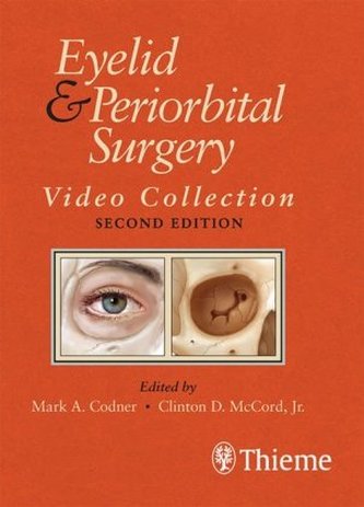 Eyelid and Periorbital Surgery, 1 USB-Stick Eyelid and Periorbital Surgery, 1 USB-Stick