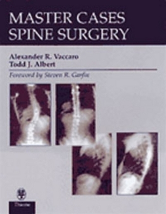 Spine Surgery