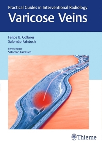 Varicose Veins: Practical Guides in Interventional Radiology Varicose Veins: Practical Guides in Interventional Radiology