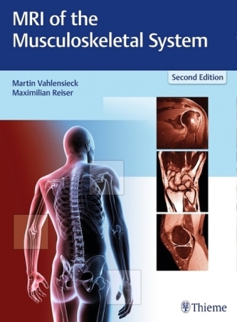 MRI of the Musculoskeletal System MRI of the Musculoskeletal System