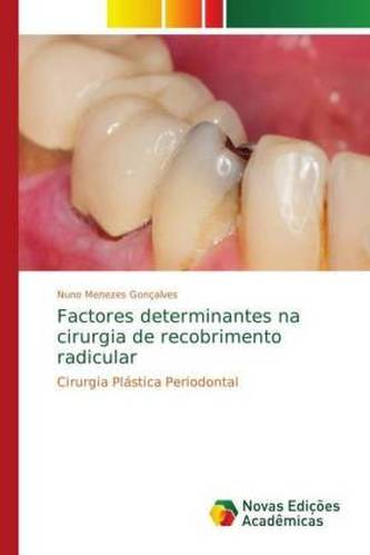 Factores determinantes na cirurgia de recobrimento radicular