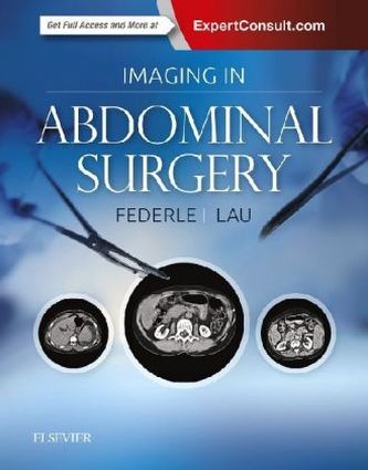 Imaging in Abdominal Surgery Imaging in Abdominal Surgery