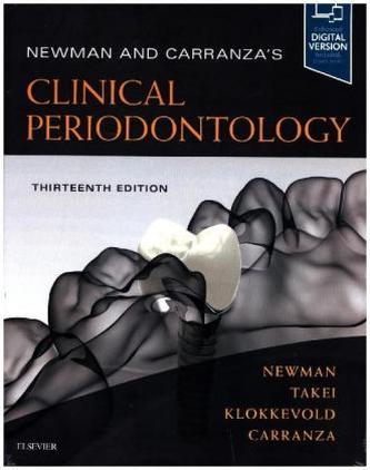 Newman and Carranza's Clinical Periodontology