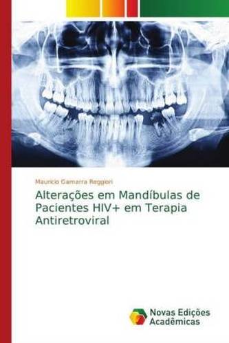 Alterações em Mandíbulas de Pacientes HIV+ em Terapia Antiretroviral Alterações em Mandíbulas de Pacientes HIV+ em Terapia Antiretroviral