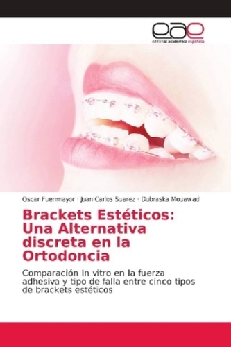 Brackets Estéticos: Una Alternativa discreta en la Ortodoncia
