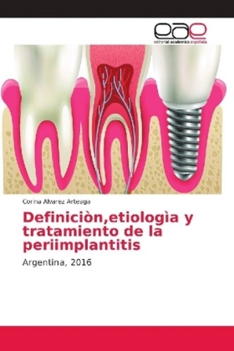 Definiciòn,etiologìa y tratamiento de la periimplantitis Definiciòn,etiologìa y tratamiento de la periimplantitis