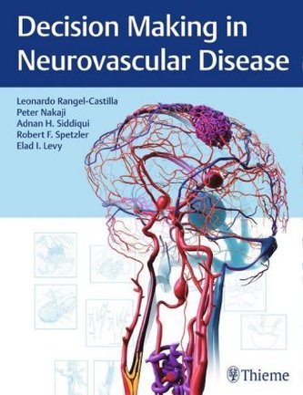 Decision Making in Neurovascular Disease Decision Making in Neurovascular Disease