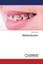 Malocclusion