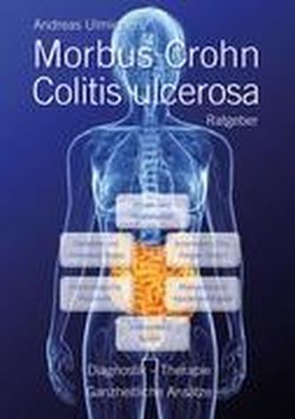 Andreas Ulmichers Morbus Crohn - Colitis ulcerosa Ratgeber