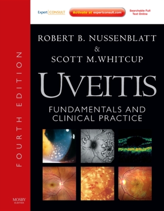 Uveitis