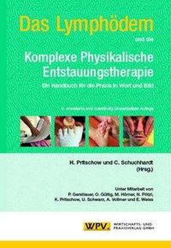 Das Lymphödem und die Komplexe Physikalische Entstauungstherapie