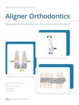 Aligner Orthodontics