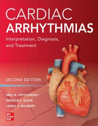 Cardiac Arrhythmias: Interpretation, Diagnosis and Treatment, Second Edition