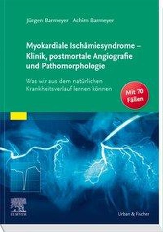 Myokardiale Ischämiesyndrome - Klinik, postmortale Angiografie und Pathomorphologie