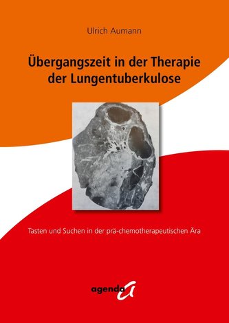 Übergangszeit in der Therapie der Lungentuberkulose