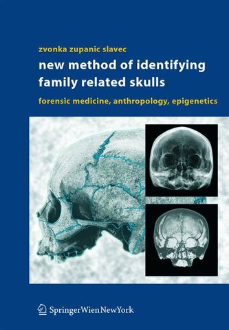 New Methods of Identifying Family Related Skulls