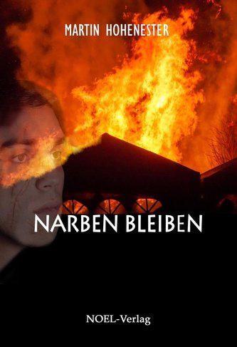 Narben bleiben