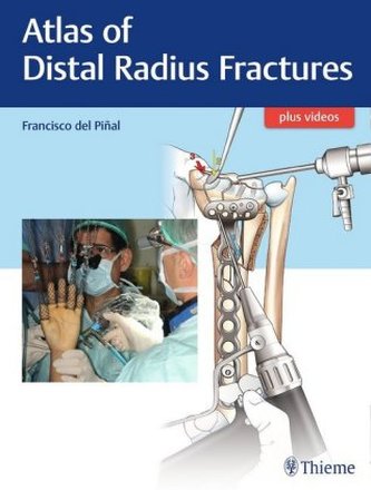 Management of Distal Radius Fractures
