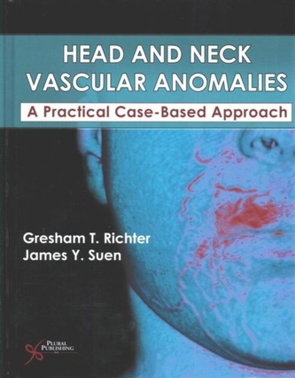 Head and Neck Vascular Anomalies Head and Neck Vascular Anomalies