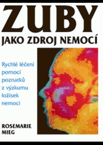 Zuby jako zdroj nemocí