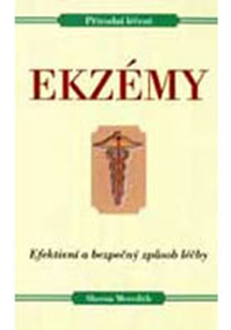 Ekzémy