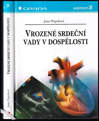 Vrozené srdeční vady v dospělosti (Jana Rubáčková Popelová, 2003)