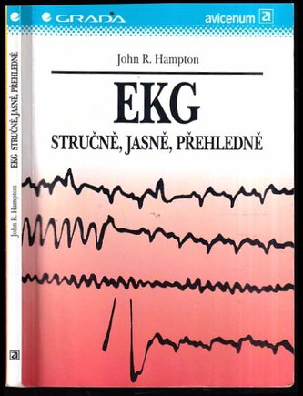 EKG - stručně, jasně, přehledně