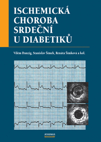 Ischemická choroba srdeční u diabetiků : epidemiologie, rizikové faktory, specifika diagnostických a terapeutických postupů u ak