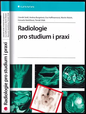 Radiologie pro studium i praxi (Zdeněk Seidl, 2012)