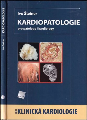 Kardiopatologie : pro patology i kardiology (Ivo Šteiner, 2010)