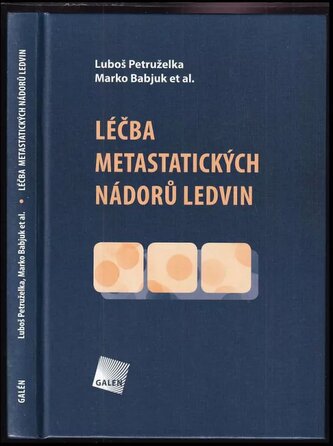 Léčba metastatických nádorů ledvin (Marko Babjuk, 2011) Léčba metastatických nádorů ledvin (Marko Babjuk, 2011)