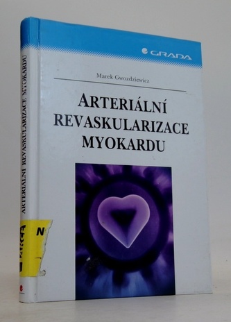 Arteriální revaskularizace myokardu