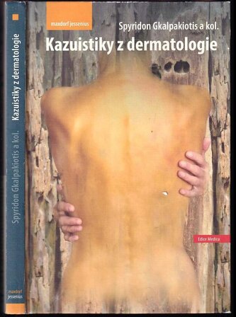 Kazuistiky z dermatologie (Spyridon Gkalpakiotis, 2021)