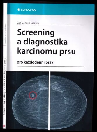 Screening a diagnostika karcinomu prsu : pro každodenní praxi (Jan Daneš, 2021)