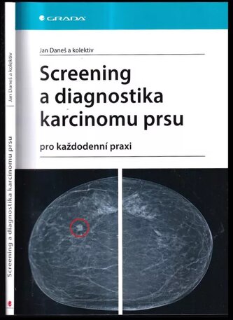 Screening a diagnostika karcinomu prsu : pro každodenní praxi (Jan Daneš, 2021)