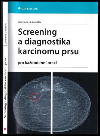 Screening a diagnostika karcinomu prsu : pro každodenní praxi (Jan Daneš, 2021)